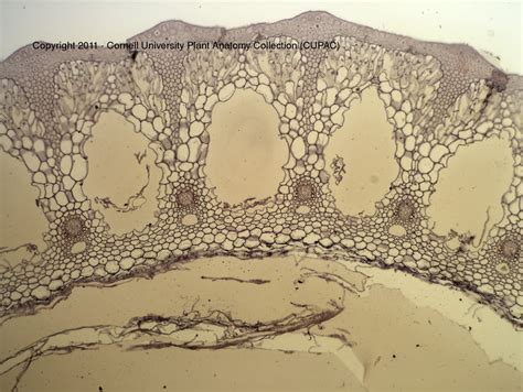 CUPAC ANATOMY SLIDE IMAGES