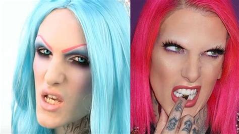 Jeffree Star Teeth Transformation: Cost, Before and After [Updated]