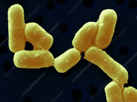 Lactobacillus fermentum - Stock Image - B220/1570 - Science Photo Library