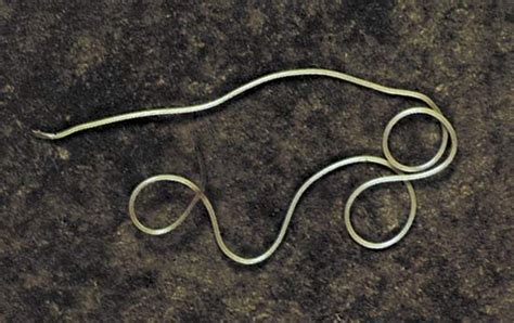 Horsehair worm | invertebrate | Britannica.com