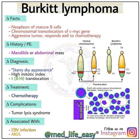 Burkitt lymphoma - MEDizzy