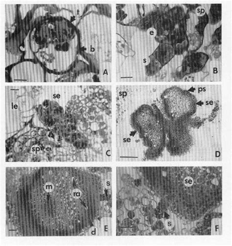 Development of representative Anthurium andraeanum somatic embryos. (A ...