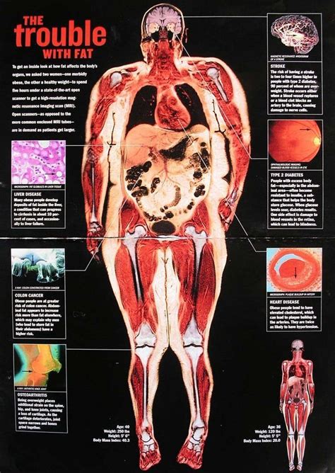 Der medizinische Ganzkörper-Scan zeigt gesundheitliche Komplikationen aufgrund Der medizinische ...