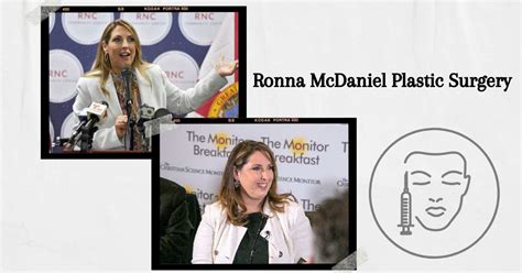 Ronna McDaniel Plastic Surgery: Did She Go Under The Knife?