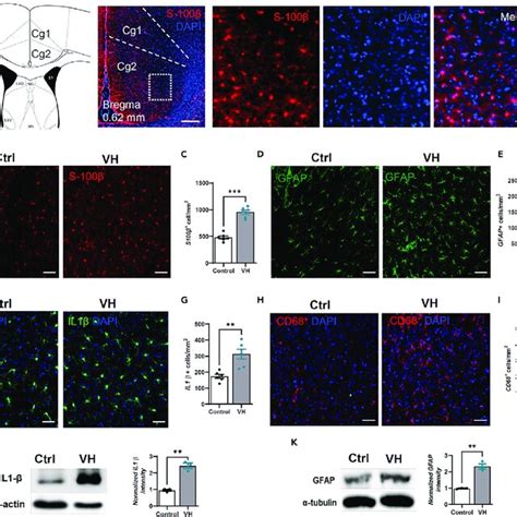 Visceral hypersensitivity causes ACC neuroinflammation and astrogliosis ...