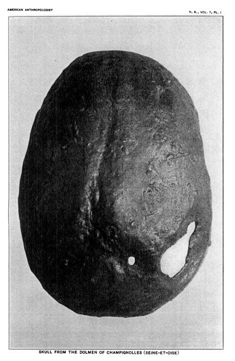 The Mystery of the T-shaped Trepanned skulls of Neolithic France (Story ...