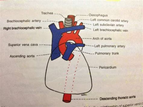 CT ANATOMY OF NORMAL MEDIASTINUM MADE EASY