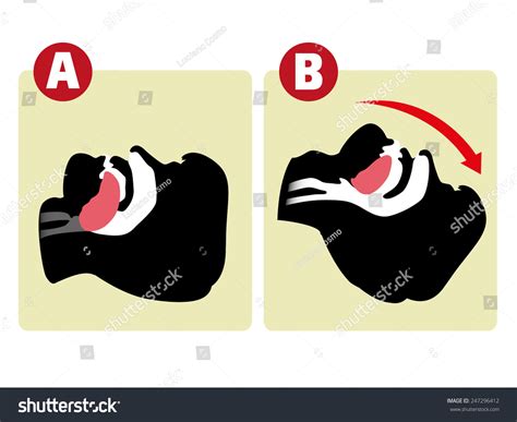 962 Mouth Mouth Resuscitation Images, Stock Photos & Vectors | Shutterstock