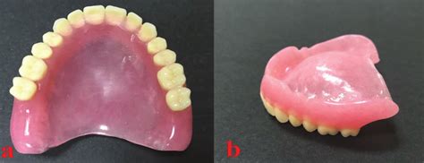 a. Polished surface of conventional maxillary heat-cured acrylic single ...