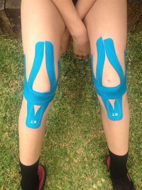 KT Tape Pro full knee support | Kt tape knee, Kinesiology taping, Knee arthritis