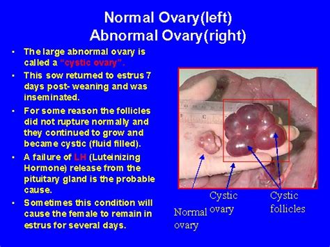 Normal Ovary(left)