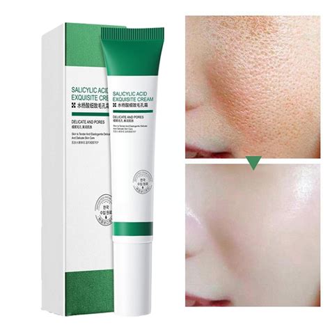 20ml Salicylic Acid Refining Cream Improve Pimple Blackhead Treatment ...