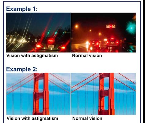 WHAT IS ASTIGMATISM ? – Cypress Eye Centre