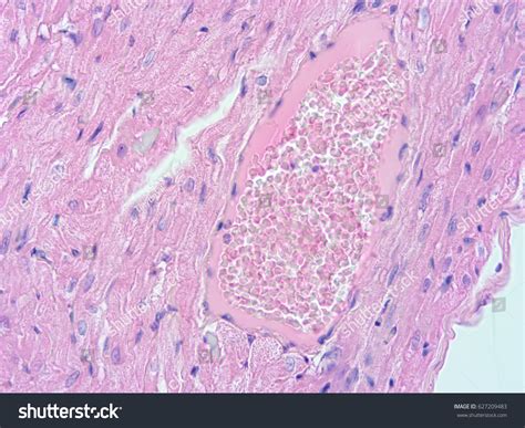 Histology Human Heart Show Cardiac Tissue Stock Photo 627209483 | Shutterstock