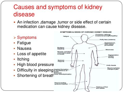 Related Keywords & Suggestions for kidney infection symptoms