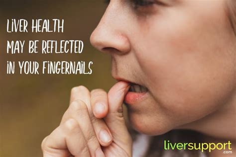 Liver Health May Be Reflected in Your Fingernails | LiverSupport.com