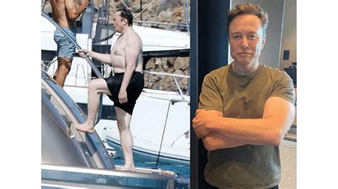 Did Elon Musk Get Weight Loss Surgery?