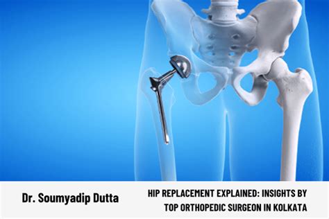 Hip Replacement Explained - Dr. Soumyadip Dutta