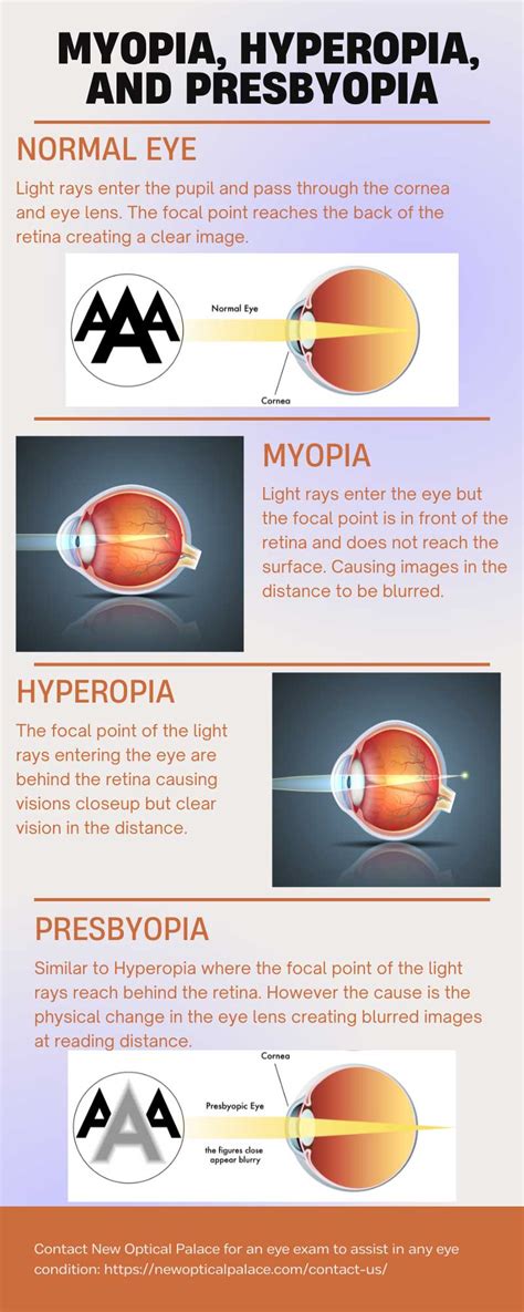 Hyperopia Diagram