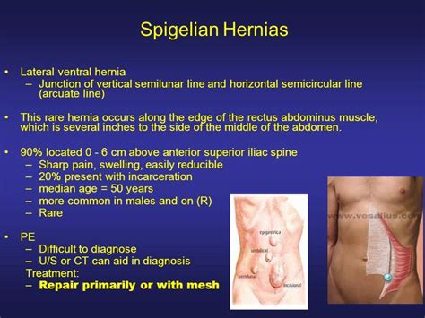 Pin on hernias- groin