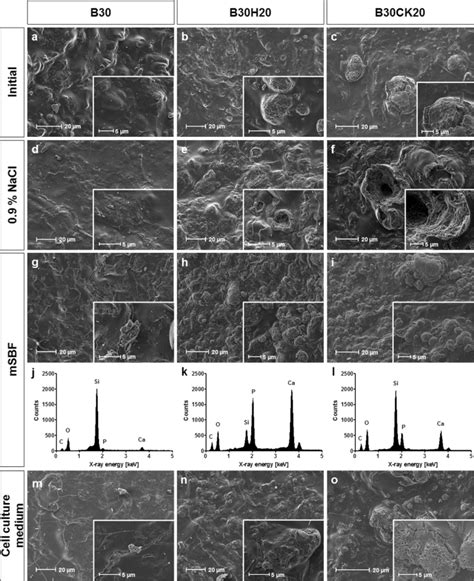 Calcite incorporated in silica/collagen xerogels mediates calcium release and enhances ...