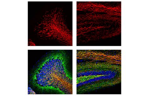 Myelin Protein Zero Antibody | Cell Signaling Technology