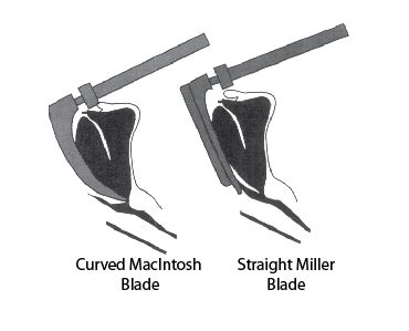 Using Straight Laryngoscopy Blades - The Airway JediThe Airway Jedi