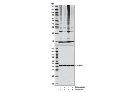 Cycloheximide | Cell Signaling Technology