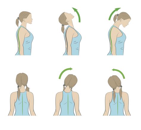 Compressed Nerve In Neck