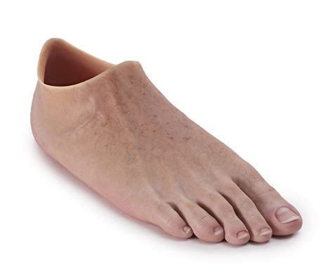 Partial foot amputation – Atlantic Prosthetic Orthotic Services Ltd