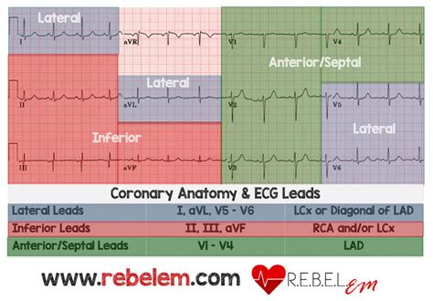 Dr. Smith's ECG Blog: Chest Pain, "Negative" Stress Tests, POCUS, & ECG Equations -- A Case from ...