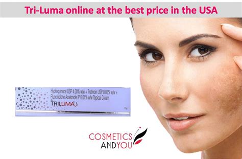 Tri-Luma Cream Price in the USA – Cosmetics and you : Acne Treatment, Careprost Eyelashes ...