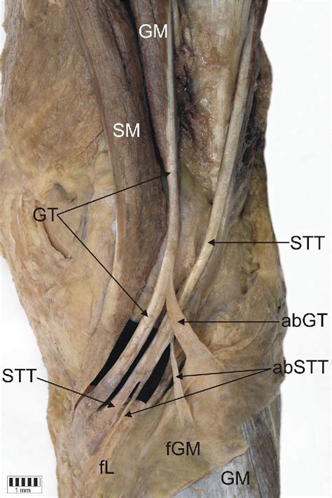 Pes anserinus (leg structure) | Semantic Scholar