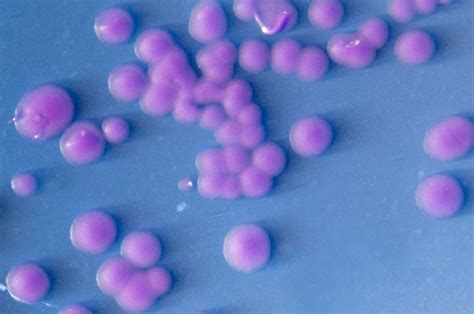 Biochemical Test of Streptococcus agalactiae