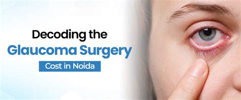 Decoding the Glaucoma Surgery Cost In Noida