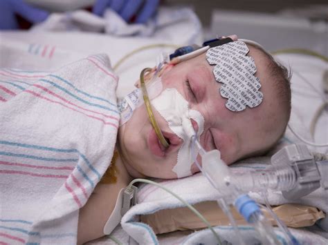 Parents celebrate formerly conjoined twins after successful surgery ...