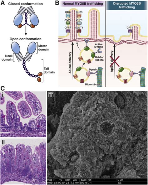 Altered MYO5B Function Underlies Microvillus Inclusion Disease: Opportunities for Intervention ...