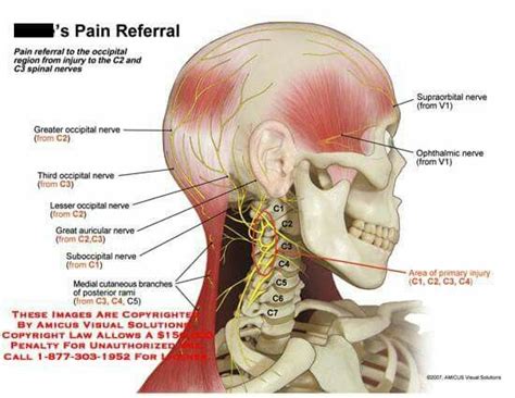 Good Illistration. | Occipital neuralgia, Nerve pain remedies, Nerve pain