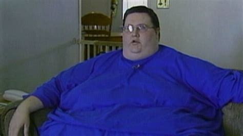 Obese Man Drops 400 lbs Without Surgery Video - ABC News