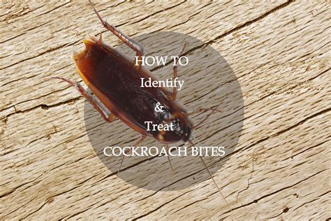 Do Cockroach Bite? Complete Guide to Prevent & Treat Roach Bites - Pest ...