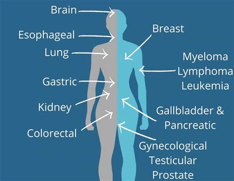 Cancer Types | Waterloo Wellington Regional Cancer Program