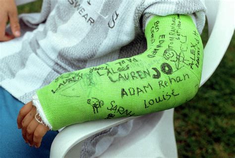 Arm Of Boy In Plaster For Broken Wrist Photograph by Jim Selby/science Photo Library - Pixels Merch