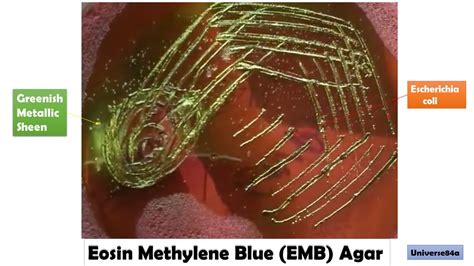 Eosin Methylene Blue (EMB) Agar: Introduction, Principle, Composition