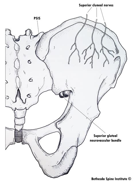 Cluneal Nerve Entrapment - Dr. William E. Morgan