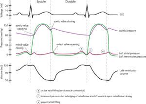 Figure 6. A Wiggers diagram is a standard diagram used in cardiac ...