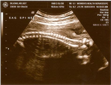 20 week ultrasound. ~ A Day with the De Jongs
