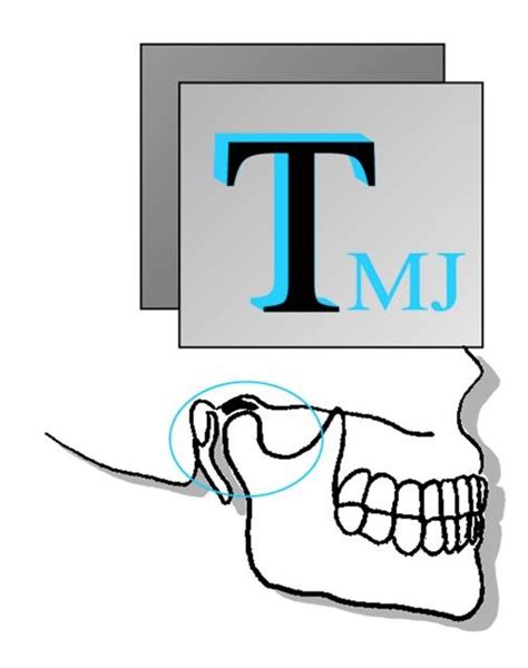 TMJ & Orofacial Pain Treatment Centers of Wisconsin