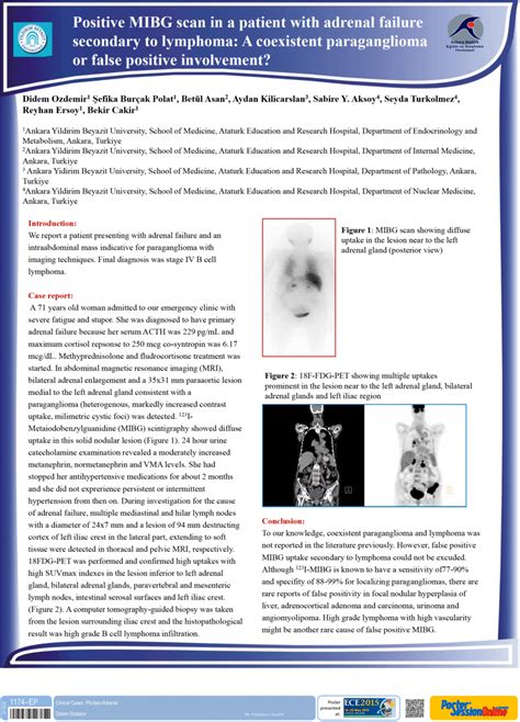 (PDF) Positive MIBG scan in a patient with adrenal failure secondary to lymphoma: a coexistent ...