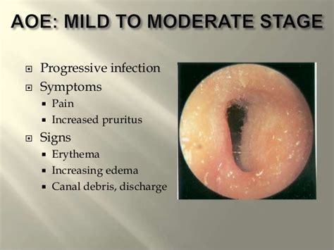 Diseases of external ear,dr.s.gopalakrishnan, 13.03.17