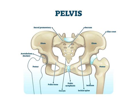 Ischial Tuberosity Bursitis